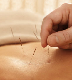 Søborg Akupunktur