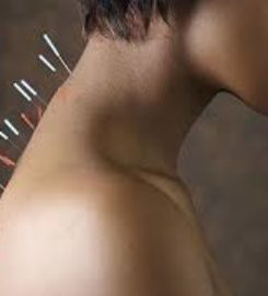 Søborg Akupunktur